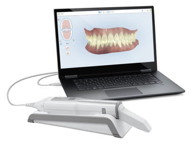 Escáner intraoral